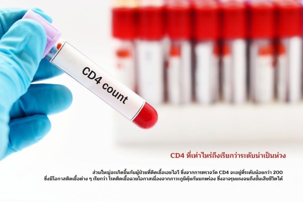 CD4 ที่เท่าไหร่ถึงเรียกว่าระดับน่าเป็นห่วง
