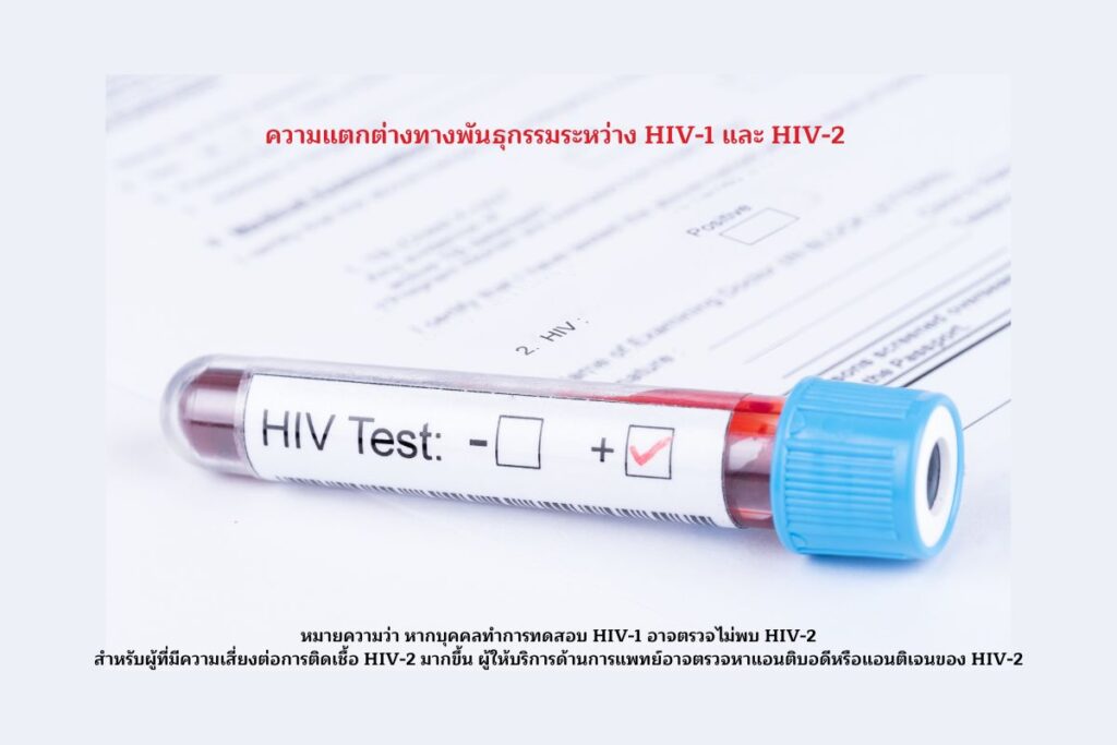 ทดสอบ HIV-1 อาจตรวจไม่พบ HIV-2