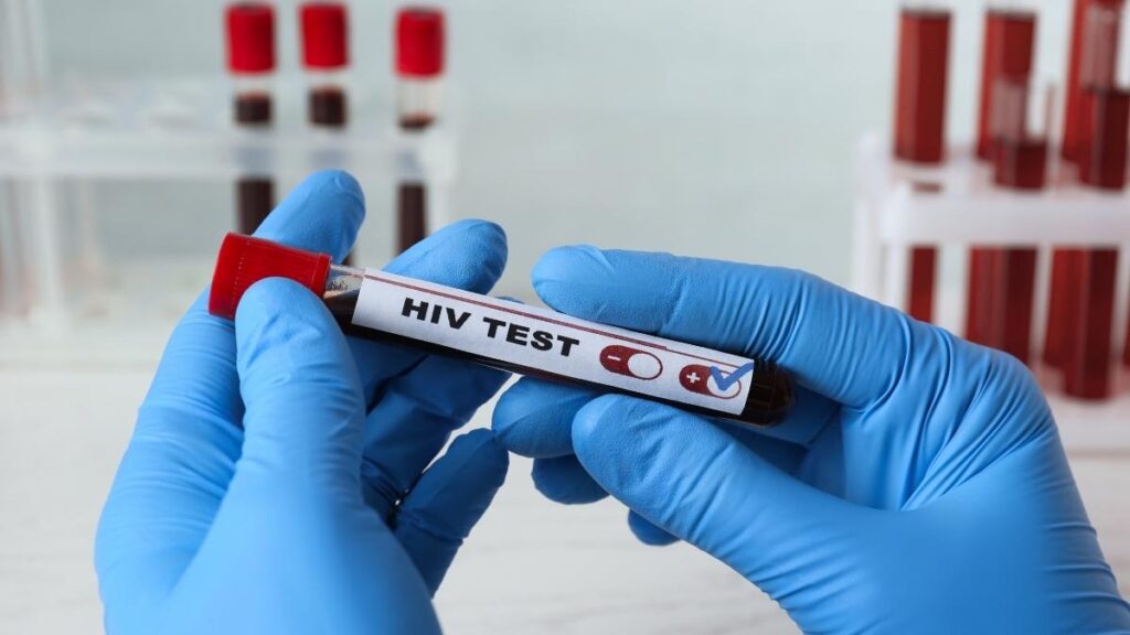 การเอาชนะอุปสรรคใน การตรวจ HIV
