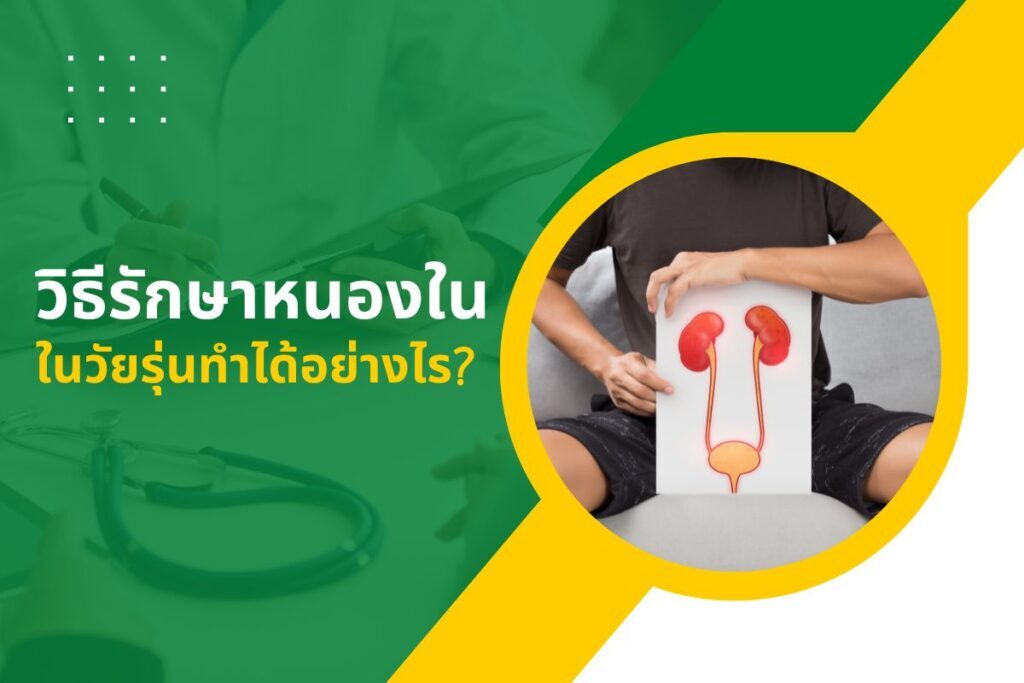 วิธีรักษาหนองใน ในวัยรุ่นทำได้อย่างไร?