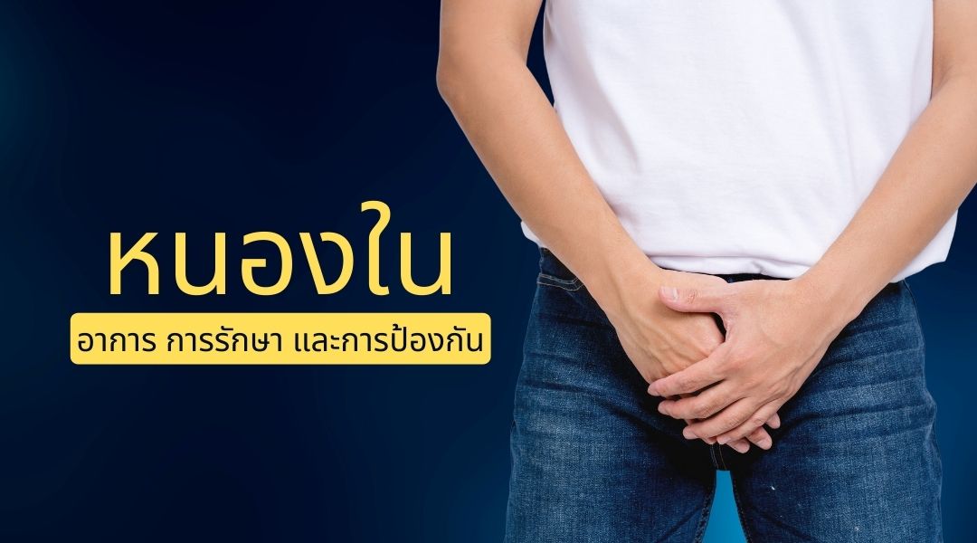 หนองใน : อาการ การรักษา และการป้องกัน : เอชไอวี [HIV]