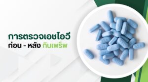 การตรวจเอชไอวี ก่อน-หลัง กินเพร็พ